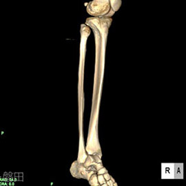 CT撮影画像整形2