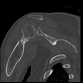 CT撮影画像整形3