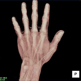 CT撮影画像整形6