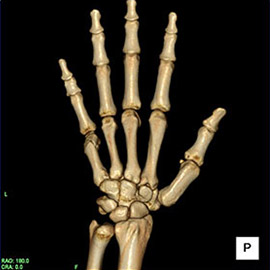 CT撮影画像整形7