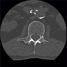 CT撮影画像整形8