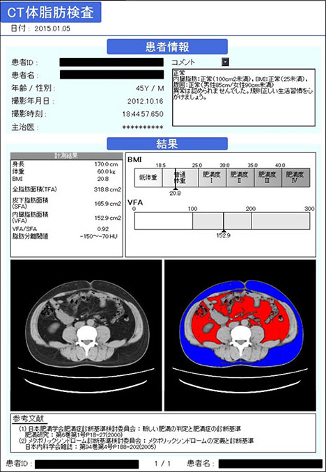 CT撮影画像体脂肪計測2